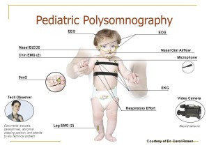 EEG. EOG. Nasal EtCO2. Nasal Oral Airflow. Chin EMG (2) Microphone. Sao2. EKG. Tech Observer. Video Camera. This illustration shows the standard types of monitoring devices used in pediatric polysomnographic evaluation in most sleep laboratories. Electroencephalography (EEG), electro-oculography (EOG) and submental electromyography (EMG) are used to monitor sleep architecture and arousals. The presence of airflow is assessed by nasal/oral thermistors and/or capnography and/or pressure transducers. Chest wall excursion is usually measured by means of inductance plethysmography or strain gauges. Intercostal EMG can be used to measure respiratory effort, particularly paradoxical chest wall movement. A pulse oximeter measures oxygenation. CO2 is generally assessed either by means of a transcutaneous CO2 monitor or an end-tidal CO2 probe; this is helpful to assess hypoventilation. The entire procedure is observed by a technician who documents arousals, parasomnias, abnormal sleeping position, and attends to any technical problem. Esophageal pH may be monitored if gastroesophageal reflux is a clinical consideration. Children usually require advance preparation, which may include a tour of the sleep lab prior to the polysomnographic evaluation. It generally requires more time and patience to set up a child for a polysomnogram, and it is usually helpful if a parent is present during the study. The sleeping room should be child-friendly, and technicians in the sleep lab should be comfortable and familiar working with children Zaremba EK, Barkey ME, Mesa C, Sanniti K, Rosen CL. Making polysomnography more child friendly: A family-centered care approach. Journal of Clinical Sleep Medicine 2005;1(2): Respiratory Effort. Documents arousals, parasomnias, abnormal sleeping position, and attends to any technical problem. Leg EMG (2) Record behavior. Courtesy of Dr. Carol Rosen.